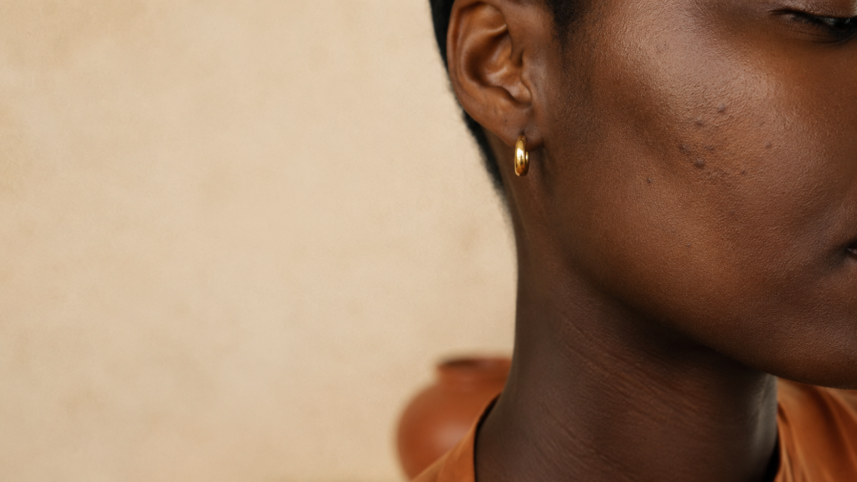 Deep brown skin, jaw and cheek with faint post-inflammatory dark marks in warm light