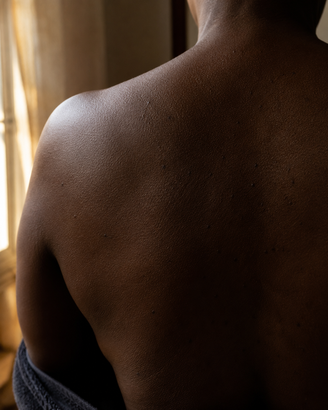 A real Fitzpatrick V-VI back and shoulder with real skin texture in warm window light.