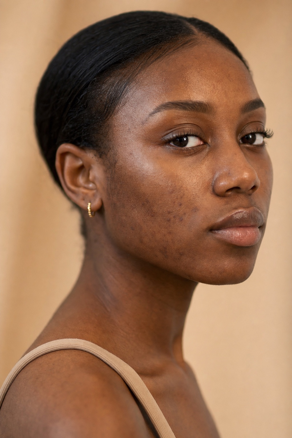 A young person with deep brown skin showing faded post-acne marks in warm light.